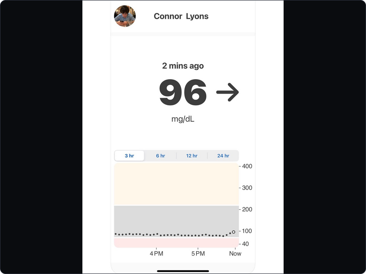 A glucose reading from Connor’s journey after his transplant—a moment our family was grateful to see. Historical screenshot.